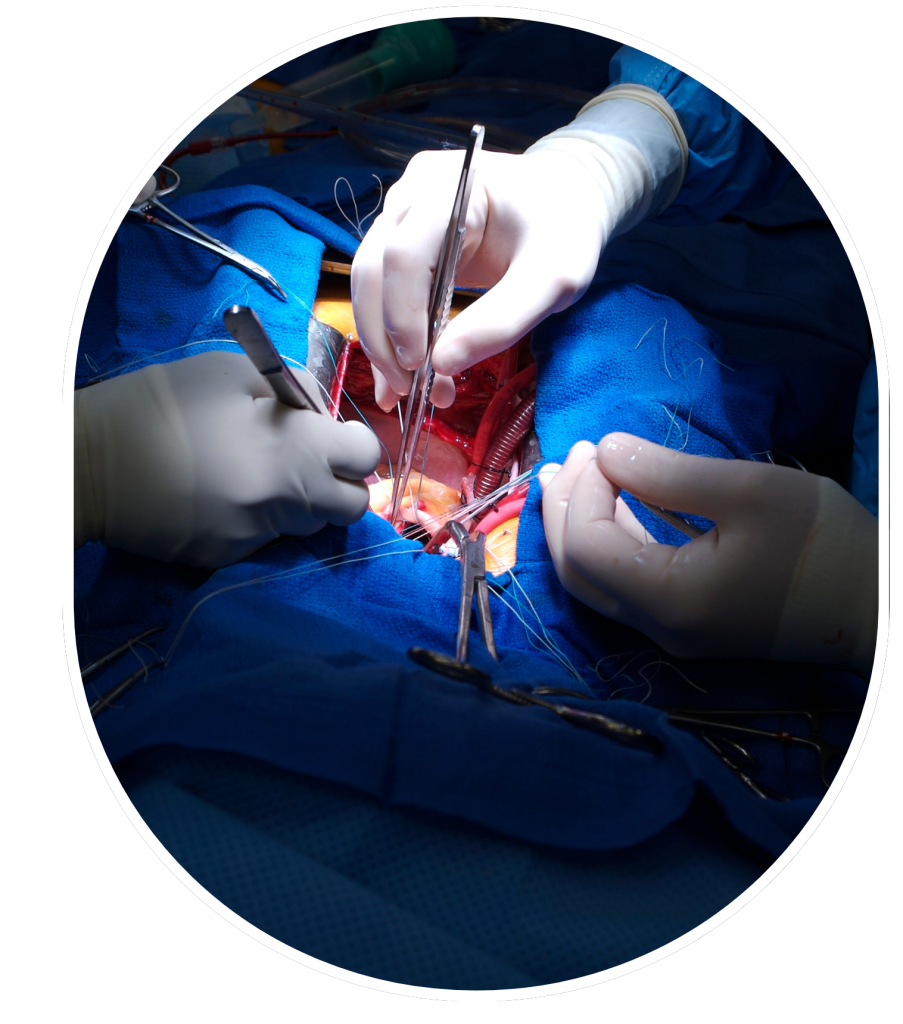 Aortic root surgery